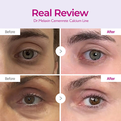 Dr.Melaxin Cemenrete Calcium Intense Cream